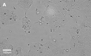 millicell-cell-lines-85090402-a Brightfield imaging of A431 cells on Millicell<sup>®</sup> DCI Digital Cell Imager at 10X magnification
