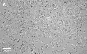 millicell-cell-lines-86012803-a Brightfield imaging of MCF-7 cells on Millicell<sup>®</sup> DCI Digital Cell Imager at 10X magnification