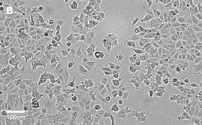 millicell-cell-lines-86012803-b Brightfield imaging of MCF-7 cells on Millicell<sup>®</sup> DCI Digital Cell Imager at 20X magnification