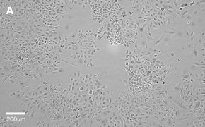 millicell-cell-lines-86012804-a Brightfield imaging of A549 cells on Millicell<sup>®</sup> DCI Digital Cell Imager at 10X magnification