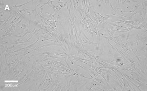 millicell-cell-lines-90020107-a Brightfield imaging of WI38 cells on Millicell<sup>®</sup> DCI Digital Cell Imager at 10X magnification
