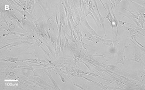 millicell-cell-lines-90020107-b Brightfield imaging of WI38 cells on Millicell<sup>®</sup> DCI Digital Cell Imager at 20X magnification
