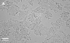 millicell-cell-lines-91091005-a Brightfield imaging of HCT116 cells on Millicell<sup>®</sup> DCI Digital Cell Imager at 10X magnification
