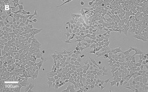 millicell-cell-lines-91091005-b Brightfield imaging of HCT116 cells on Millicell<sup>®</sup> DCI Digital Cell Imager at 20X magnification