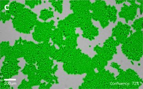 millicell-cell-lines-91091005-c Brightfield imaging of HCT116 cells on Millicell<sup>®</sup> DCI Digital Cell Imager at 10X magnification with mask
