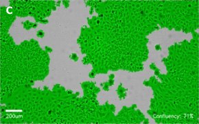 millicell-cell-lines-93021013-c Brightfield imaging of HeLa cells on Millicell<sup>®</sup> DCI Digital Cell Imager at 10X magnification with mask