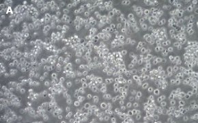ALMC-1 cells imaged on Millicell® DCI Digital Cell Imager Brightfield imaging of ALMC-1 cells on Millicell<sup>®</sup> DCI Digital Cell Imager at 10X magnification
