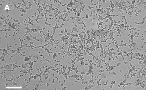 Oli-neu oligodendrocytes imaged on Millicell<sup>®</sup> DCI Digital Cell Imager Brightfield imaging of Oli-neu oligodendrocytes on Millicell<sup>®</sup> DCI Digital Cell Imager at 10X magnification