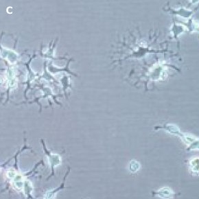 Differentiated Oli-neu oligodendrocytes Differentiated Oli-neu oligodendrocytes imaged using the Millicell<sup>®</sup> DCI Digital Cell Imager