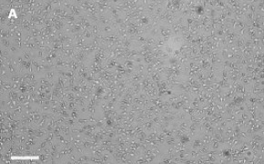 OSUMMER.1 cells imaged on Millicell<sup>®</sup> DCI Digital Cell Imager Brightfield imaging of OSUMMER.1 cells on Millicell<sup>®</sup> DCI Digital Cell Imager at 10X magnification