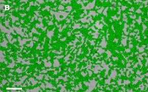 Masked OSUMMER.1 cells on Millicell<sup>®</sup> DCI Digital Cell Imager Brightfield imaging of OSUMMER.1 cells on Millicell<sup>®</sup> DCI Digital Cell Imager at 10X magnification with mask