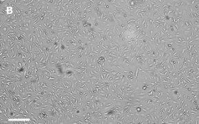 Masked OSUMMER.10 cells on Millicell<sup>®</sup> DCI Digital Cell Imager Brightfield imaging of OSUMMER.10 cells on Millicell<sup>®</sup> DCI Digital Cell Imager at 10X magnification with mask