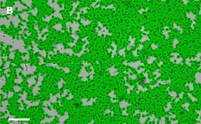 Masked OSUMMER.11 cells on Millicell<sup>®</sup> DCI Digital Cell Imager Brightfield imaging of OSUMMER.11 cells on Millicell<sup>®</sup> DCI Digital Cell Imager at 10X magnification with mask