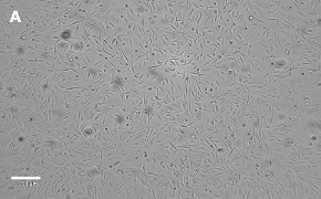 OSUMMER.2 cells imaged on Millicell<sup>®</sup> DCI Digital Cell Imager Brightfield imaging of OSUMMER.2 cells on Millicell<sup>®</sup> DCI Digital Cell Imager at 10X magnification