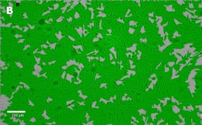 Masked OSUMMER.2 cells on Millicell<sup>®</sup> DCI Digital Cell Imager Brightfield imaging of OSUMMER.2 cells on Millicell<sup>®</sup> DCI Digital Cell Imager at 10X magnification with mask