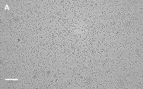 OSUMMER.3 cells imaged on Millicell<sup>®</sup> DCI Digital Cell Imager Brightfield imaging of OSUMMER.3 cells on Millicell<sup>®</sup> DCI Digital Cell Imager at 10X magnification