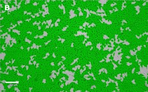 Masked OSUMMER.3 cells on Millicell<sup>®</sup> DCI Digital Cell Imager Brightfield imaging of OSUMMER.3 cells on Millicell<sup>®</sup> DCI Digital Cell Imager at 10X magnification with mask
