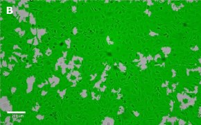 Masked OSUMMER.8 cells on Millicell<sup>®</sup> DCI Digital Cell Imager Brightfield imaging of OSUMMER.8 cells on Millicell<sup>®</sup> DCI Digital Cell Imager at 10X magnification with mask