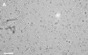 Scp2 cells imaged on Millicell<sup>®</sup> DCI Digital Cell Imager Brightfield imaging of Scp2 cells on Millicell<sup>®</sup> DCI Digital Cell Imager at 10X magnification