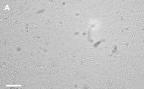 CNS-1 cells imaged on Millicell<sup>®</sup> DCI Digital Cell Imager Brightfield imaging of CNS-1 cells on Millicell<sup>®</sup> DCI Digital Cell Imager at 10X magnification