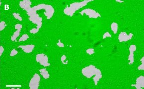 Masked CNS-1 cells on Millicell<sup>®</sup> DCI Digital Cell Imager Brightfield imaging of CNS-1 cells on Millicell<sup>®</sup> DCI Digital Cell Imager at 10X magnification with mask