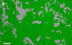 Masked LX-2 Cas9 cells on Millicell<sup>®</sup> DCI Digital Cell Imager Brightfield imaging of LX-2 Cas9 cells on Millicell<sup>®</sup> DCI Digital Cell Imager at 10X magnification with mask