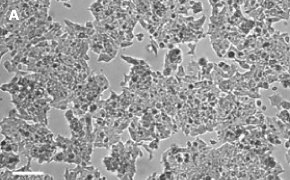 MCF-7 BUS cells imaged on Millicell<sup>®</sup> DCI Digital Cell Imager Brightfield imaging of MCF-7 BUS cells on Millicell<sup>®</sup> DCI Digital Cell Imager at 10X magnification