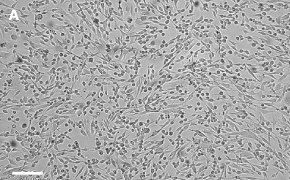 OSUMMER.4 cells imaged on Millicell<sup>®</sup> DCI Digital Cell Imager Brightfield imaging of OSUMMER.4 cells on Millicell<sup>®</sup> DCI Digital Cell Imager at 10X magnification