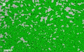 Masked OSUMMER.4 cells on Millicell<sup>®</sup> DCI Digital Cell Imager Brightfield imaging of OSUMMER.4 cells on Millicell<sup>®</sup> DCI Digital Cell Imager at 10X magnification with mask