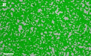 Masked OSUMMER.6 cells on Millicell<sup>®</sup> DCI Digital Cell Imager Brightfield imaging of OSUMMER.6 cells on Millicell<sup>®</sup> DCI Digital Cell Imager at 10X magnification with mask