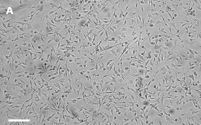 OSUMMER.7 cells imaged on Millicell<sup>®</sup> DCI Digital Cell Imager Brightfield imaging of OSUMMER.7 cells on Millicell<sup>®</sup> DCI Digital Cell Imager at 10X magnification