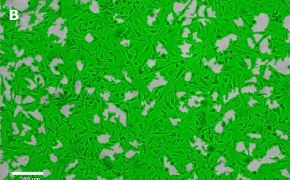 Masked OSUMMER.7 cells on Millicell<sup>®</sup> DCI Digital Cell Imager Brightfield imaging of OSUMMER.7 cells on Millicell<sup>®</sup> DCI Digital Cell Imager at 10X magnification with mask