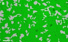 Masked OSUMMER.9 cells on Millicell<sup>®</sup> DCI Digital Cell Imager Brightfield imaging of OSUMMER.9 cells on Millicell<sup>®</sup> DCI Digital Cell Imager at 10X magnification with mask
