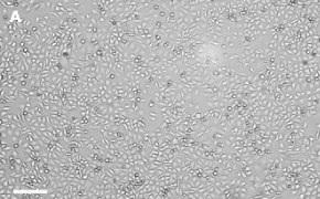 T24T cells imaged on Millicell<sup>®</sup> DCI Digital Cell Imager Brightfield imaging of T24T cells on Millicell<sup>®</sup> DCI Digital Cell Imager at 10X magnification