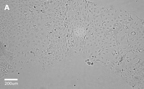 Caco-2 cells imaged on Millicell<sup>®</sup> DCI Digital Cell Imager, 10X Brightfield imaging of Caco-2 cells on Millicell<sup>®</sup> DCI Digital Cell Imager at 10X magnification