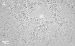 CHO-K1 cells imaged on Millicell<sup>®</sup> DCI Digital Cell Imager, 10X Brightfield imaging of CHO-K1 cells on Millicell<sup>®</sup> DCI Digital Cell Imager at 10X magnification