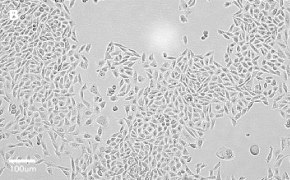 CHO-K1 cells imaged on Millicell<sup>®</sup> DCI Digital Cell Imager, 20X Brightfield imaging of CHO-K1 cells on Millicell<sup>®</sup> DCI Digital Cell Imager at 20X magnification