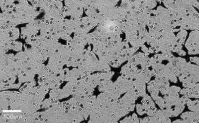 Crystal violet-stained cells imaged using a Millicell<sup>®</sup> DCI Brightfield image of cells with little cell staining. A 100 µm bar is shown for scale.