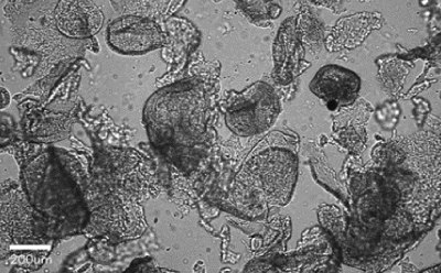 Fragmented organoids imaged using Millicell<sup>®</sup> DCI Brightfield image showing fragmented organoids appearing with cell debris, with 200 µm bar for scale.