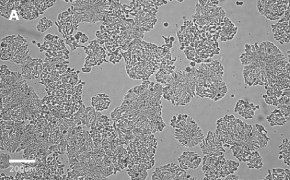 HT29 cells imaged on Millicell<sup>®</sup> DCI Digital Cell Imager, 10X Brightfield imaging of HT29 cells on Millicell<sup>®</sup> DCI Digital Cell Imager at 10X magnification