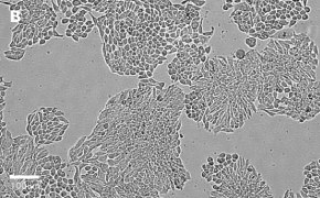 HT29 cells imaged on Millicell<sup>®</sup> DCI Digital Cell Imager, 20X Brightfield imaging of HT29 cells on Millicell<sup>®</sup> DCI Digital Cell Imager at 20X magnification