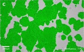 Masked HT29 cells on Millicell<sup>®</sup> DCI Digital Cell Imager Brightfield imaging of HT29 cells on Millicell<sup>®</sup> DCI Digital Cell Imager at 10X magnification with mask