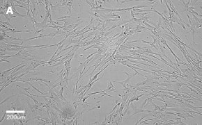 IMR-90 cells imaged on Millicell<sup>®</sup> DCI Digital Cell Imager, 10X Brightfield imaging of IMR-90 cells on Millicell<sup>®</sup> DCI Digital Cell Imager at 10X magnification