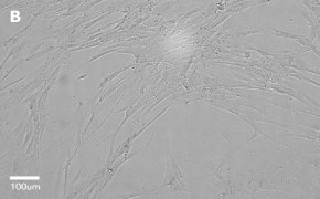 IMR-90 cells imaged on Millicell<sup>®</sup> DCI Digital Cell Imager, 20X Brightfield imaging of IMR-90 cells on Millicell<sup>®</sup> DCI Digital Cell Imager at 20X magnification