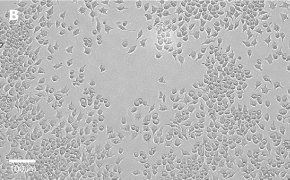 J774A.1 cells imaged on Millicell<sup>®</sup> DCI Digital Cell Imager, 20X Brightfield imaging of J774A.1 cells on Millicell<sup>®</sup> DCI Digital Cell Imager at 20X magnification
