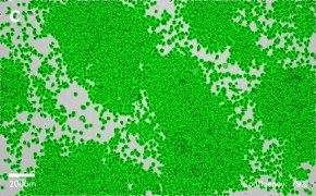 Masked J774A.1 cells on Millicell<sup>®</sup> DCI Digital Cell Imager Brightfield imaging of J774A.1 cells on Millicell<sup>®</sup> DCI Digital Cell Imager at 10X magnification with mask