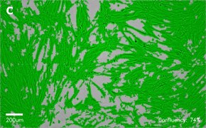Masked IMR-90 cells on Millicell<sup>®</sup> DCI Digital Cell Imager Brightfield imaging of IMR-90 cells on Millicell<sup>®</sup> DCI Digital Cell Imager at 10X magnification with mask