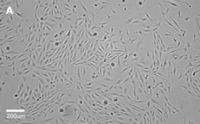 MDCK cells imaged on Millicell<sup>®</sup> DCI Digital Cell Imager, 10X Brightfield imaging of MDCK cells on Millicell<sup>®</sup> DCI Digital Cell Imager at 10X magnification