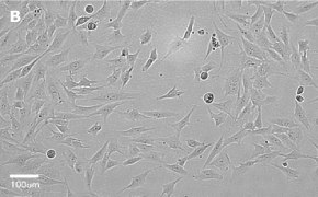 MG-63 cells imaged on Millicell<sup>®</sup> DCI Digital Cell Imager, 20X Brightfield imaging of MG-63 cells on Millicell<sup>®</sup> DCI Digital Cell Imager at 20X magnification