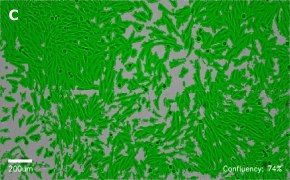 Masked MG-63 cells on Millicell<sup>®</sup> DCI Digital Cell Imager Brightfield imaging of MG-63 cells on Millicell<sup>®</sup> DCI Digital Cell Imager at 10X magnification with mask